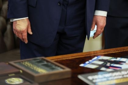 Presidente Trump aparece novamente com mão maquiada após diagnóstico de insuficiência venosa.