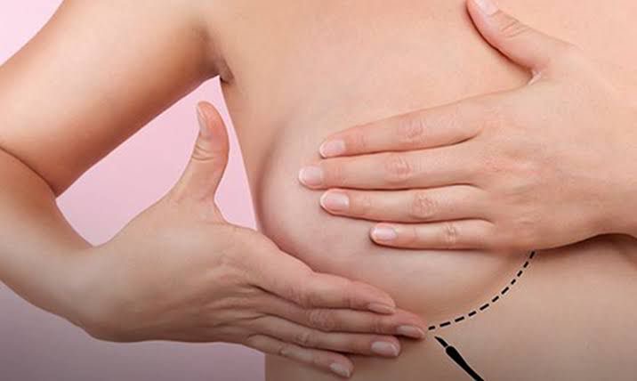 Câmara de Parnamirim vai promover evento com foco em prevenção e autocuidado feminino