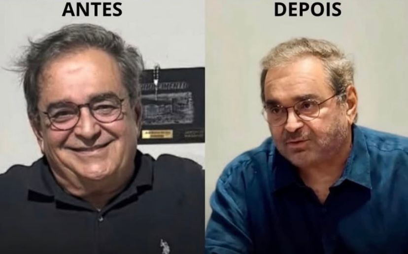 Álvaro Dias vai a SP fazer plástica e tenta despistar Natalenses