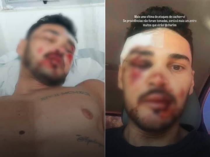Fúria de cães soltos na rua quase mata jovem em Ipueira (RN)