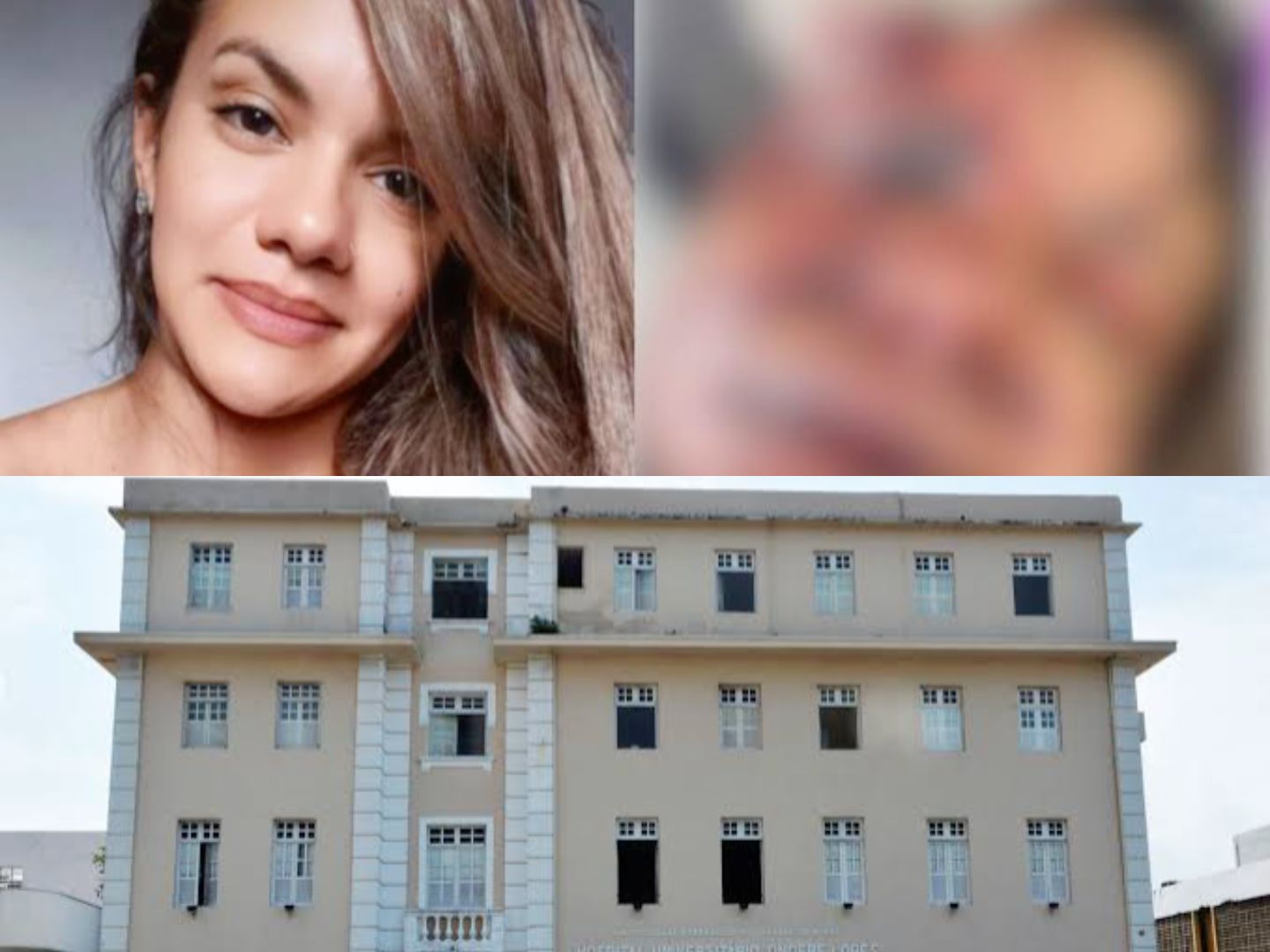 Provavelmente terá sequelas, diz cirurgião de Mulher agredida no elevador