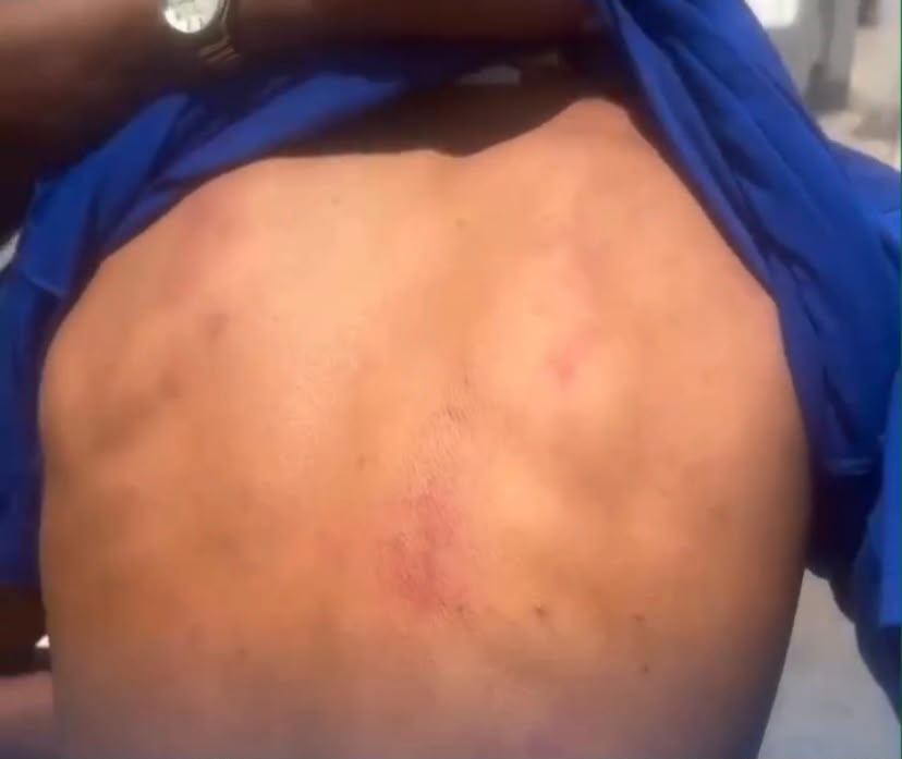 Mãe de jovem autista se revolta após abordagem policial
